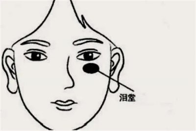 ​泪堂痣可不可以去掉
