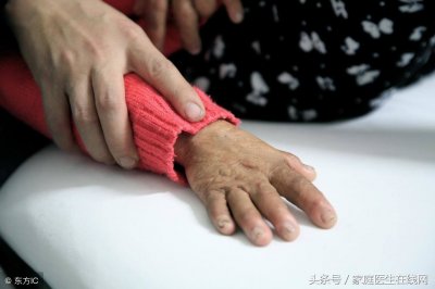 ​皮肤科医生教你烫伤后的正确处理方法